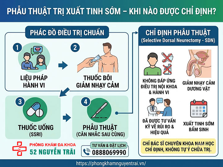 Chữa xuất tinh sớm ở đâu tốt? Chi phí và quy trình khám 4 Phẫu thuật trị xuất tinh sớm