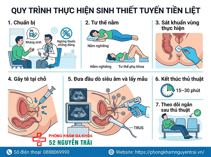 Sinh thiết tuyến tiền liệt có đau không? Giải đáp chi tiết 3 Quy trình thực hiện Sinh thiết tuyến tiền liệt từng bước