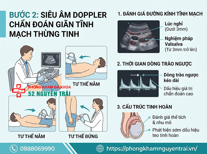 Chẩn Đoán Giãn Tĩnh Mạch Thừng Tinh Bằng Siêu Âm Doppler 3 Siêu âm Doppler chẩn đoán giãn tĩnh mạch thừng tinh