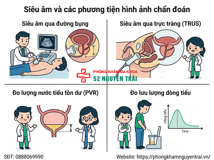 Chẩn đoán phì đại tuyến tiền liệt: Siêu âm, xét nghiệm 2 Siêu âm và các phương tiện hình ảnh chẩn đoán