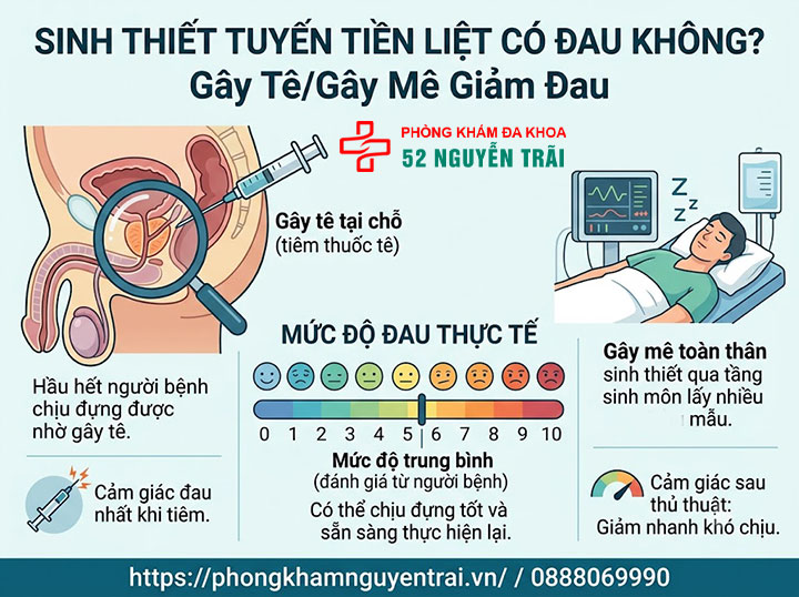 Sinh thiết tuyến tiền liệt có đau không? Giải đáp chi tiết 2 Sinh thiết tuyến tiền liệt có đau không? Mức độ đau thực tế, gây tê/gây mê