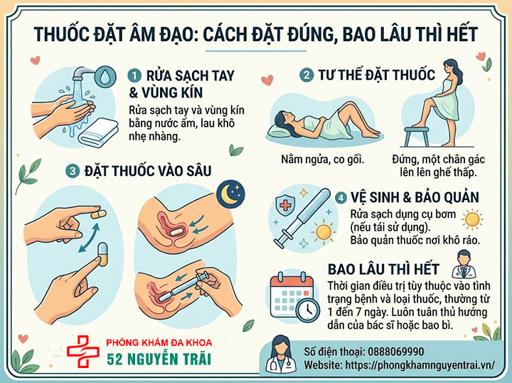 Cách Chữa Viêm Âm Đạo: Thuốc Uống, Thuốc Đặt Hiệu Quả 3 Thuốc đặt âm đạo: cách đặt đúng, bao lâu thì hết
