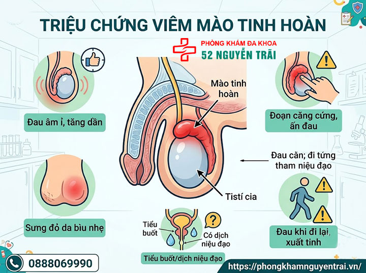 Triệu Chứng Viêm Mào Tinh Hoàn Trái, Phải Cần Biết 1 Triệu Chứng Viêm Mào Tinh Hoàn