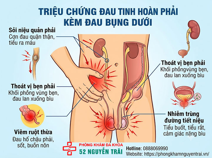 Đau Tinh Hoàn Bên Phải: Nguyên Nhân & Cách Điều Trị 5 Triệu chứng đau tinh hoàn phải kèm đau bụng dưới