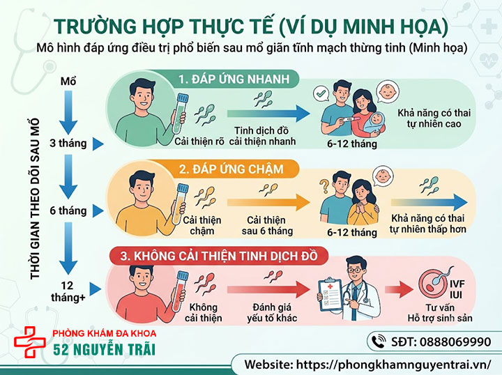 Kết Quả Sau Mổ Giãn Tĩnh Mạch Thừng Tinh: Bao Lâu Có Con? 5 Trường hợp thực tế