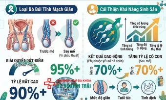 Kết Quả Sau Mổ Giãn Tĩnh Mạch Thừng Tinh: Bao Lâu Có Con?