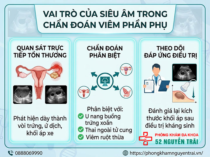 Điều Trị Viêm Phần Phụ: Kháng Sinh Và Phác Đồ Hiệu Quả 7 Vai trò của siêu âm trong chẩn đoán viêm phần phụ