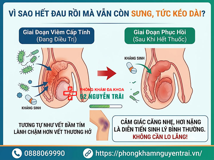 Viêm Mào Tinh Hoàn Bao Lâu Thì Khỏi? Thời Gian Điều Trị 4 Vì Sao Hết Đau Rồi Mà Vẫn Còn Sưng, Tức Kéo Dài?