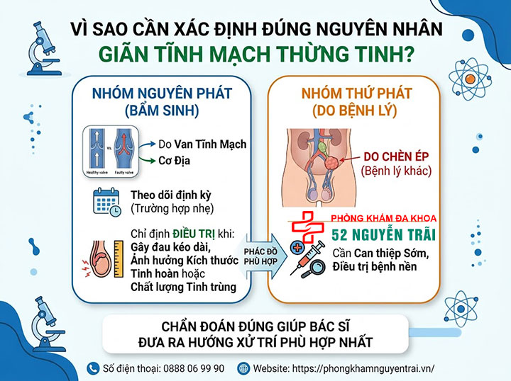 Nguyên Nhân Giãn Tĩnh Mạch Thừng Tinh Ở Nam Giới 5 Vì sao cần xác định đúng nguyên nhân giãn tĩnh mạch thừng tinh?