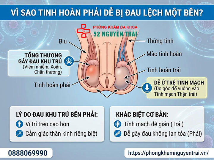 Đau Tinh Hoàn Bên Phải: Nguyên Nhân & Cách Điều Trị 1 Vì sao tinh hoàn phải dễ bị đau lệch một bên?