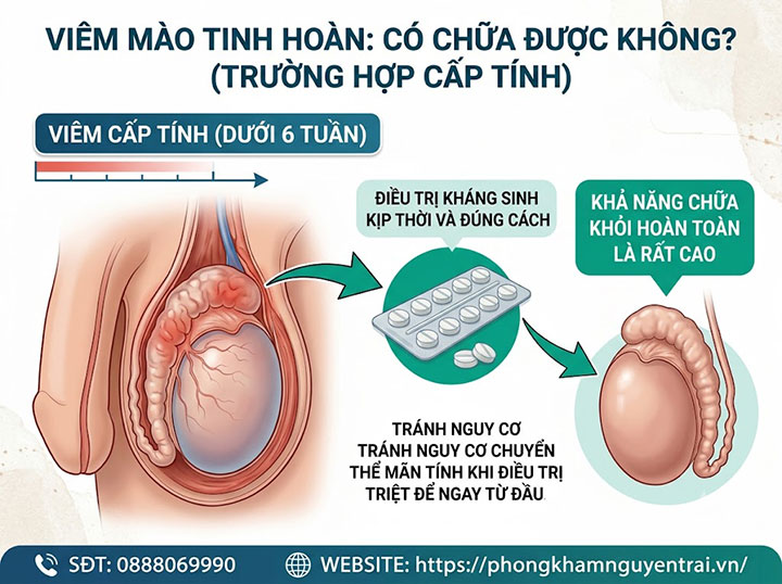 Viêm Mào Tinh Hoàn Mãn Tính Có Chữa Được Không? 8 Viêm Mào Tinh Hoàn Có Chữa Được Không? (Trường Hợp Cấp Tính)