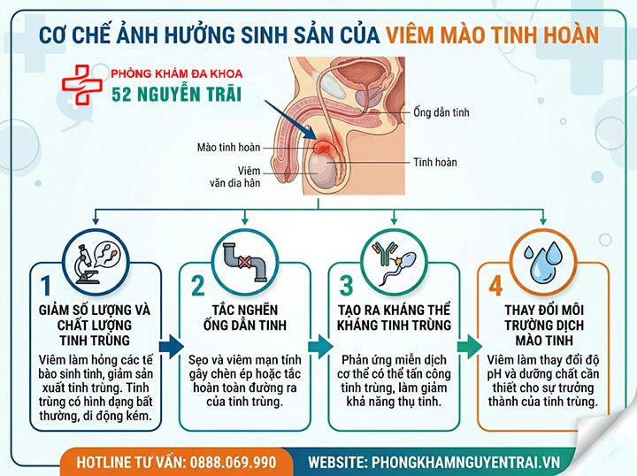 Viêm Mào Tinh Hoàn Có Nguy Hiểm Không? Biến Chứng Gì? 3 Viêm Mào Tinh Hoàn Có Gây Vô Sinh Không?