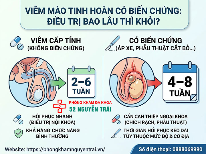 Viêm Mào Tinh Hoàn Bao Lâu Thì Khỏi? Thời Gian Điều Trị 6 Viêm Mào Tinh Hoàn Điều Trị Bao Lâu Thì Khỏi Nếu Có Biến Chứng?