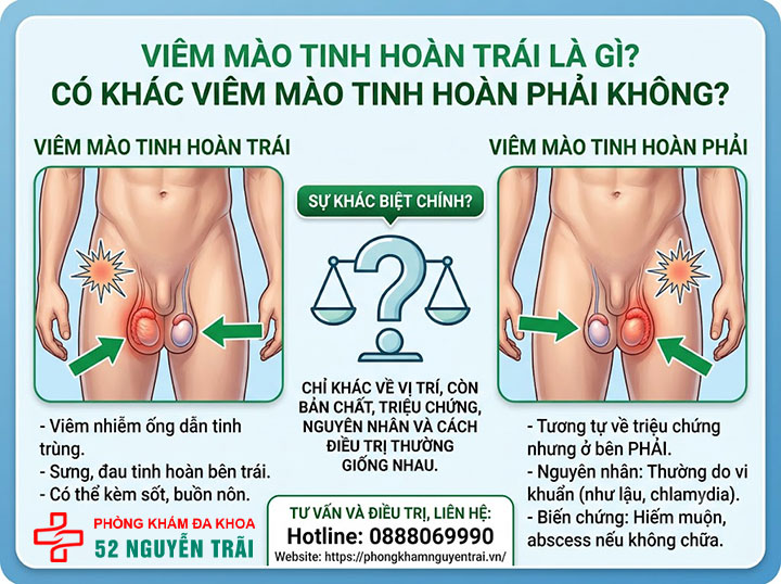 Triệu Chứng Viêm Mào Tinh Hoàn Trái, Phải Cần Biết 6 Viêm Mào Tinh Hoàn Trái Là Gì? Có Khác Viêm Mào Tinh Hoàn Phải Không?