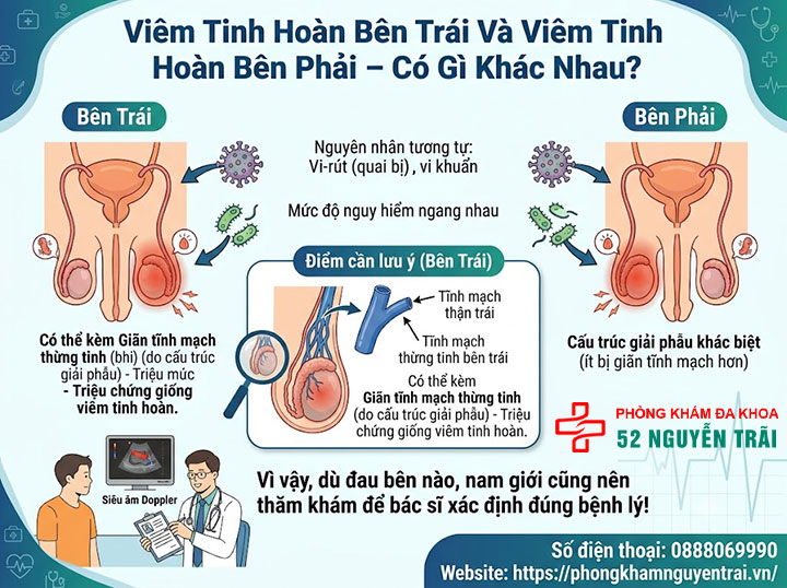 Dấu Hiệu, Triệu Chứng Viêm Tinh Hoàn Cần Biết Sớm 4 Viêm Tinh Hoàn Bên Trái Và Viêm Tinh Hoàn Bên Phải – Có Gì Khác Nhau?