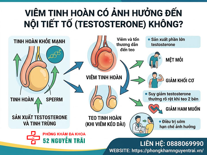 Viêm Tinh Hoàn Có Nguy Hiểm Không? Biến Chứng Cần Biết 4 Viêm Tinh Hoàn Có Ảnh Hưởng Đến Nội Tiết Tố (Testosterone) Không?