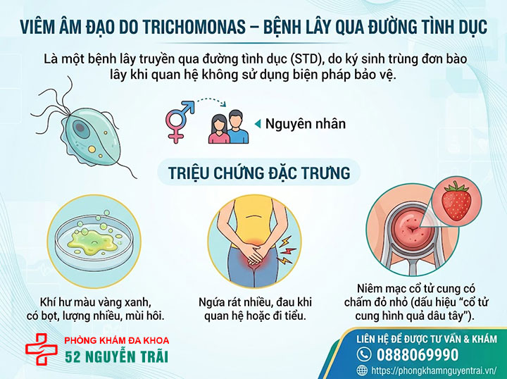 Viêm âm đạo do nấm Candida, Gardnerella, Trichomonas: Phân biệt và điều trị 3 Viêm âm đạo do Trichomonas