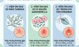 Viêm âm đạo do nấm Candida, Gardnerella, Trichomonas: Phân biệt và điều trị