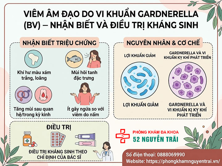 Viêm âm đạo do nấm Candida, Gardnerella, Trichomonas: Phân biệt và điều trị 2 Viêm âm đạo do vi khuẩn Gardnerella