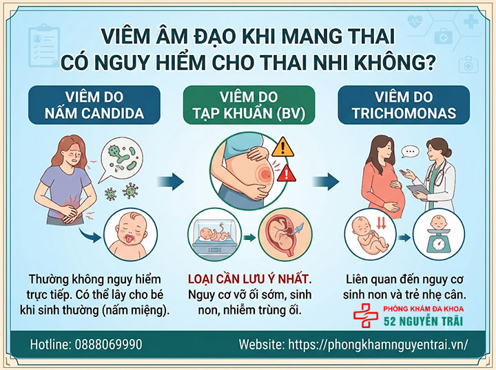 Viêm Âm Đạo Khi Mang Thai: Nguy Hiểm Không, Chữa Sao? 2 Viêm âm đạo khi mang thai có nguy hiểm cho thai nhi không?