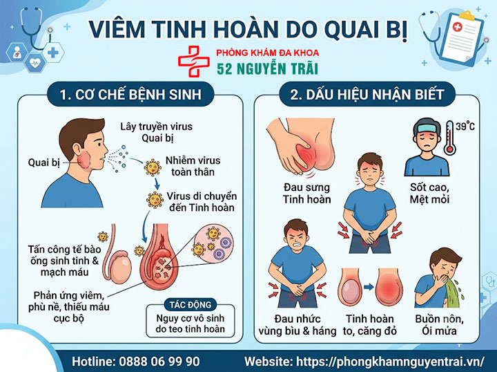 Quai bị đau tinh hoàn: Biến chứng nguy hiểm cần biết 2 Viêm tinh hoàn do quai bị