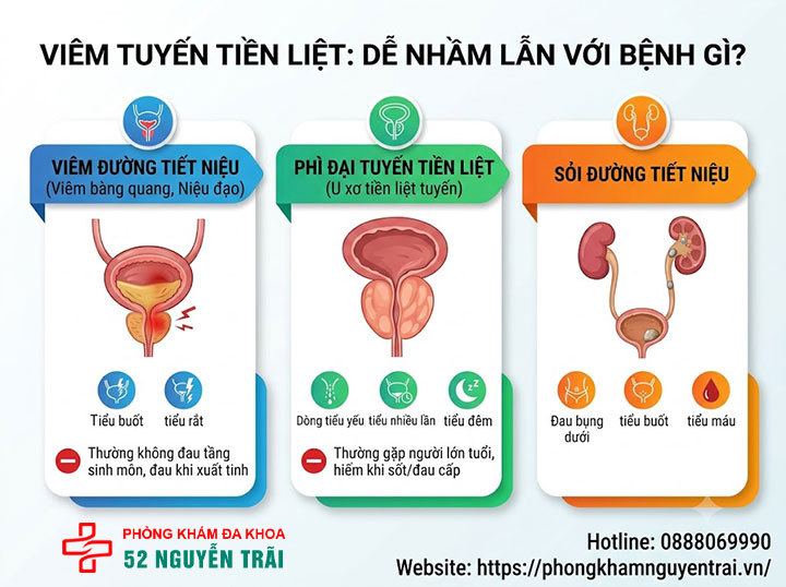 Dấu hiệu viêm tuyến tiền liệt: Nhận biết sớm ở nam giới 4 Viêm tuyến tiền liệt Dễ nhầm lẫn với bệnh gì?