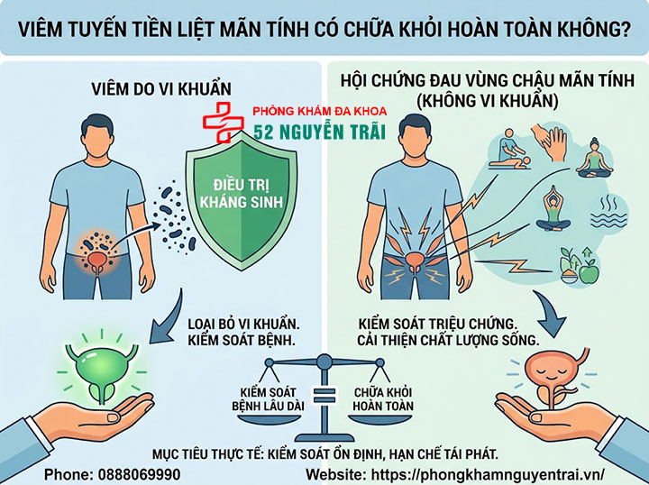 Viêm tuyến tiền liệt mãn tính có chữa khỏi được không? 4 Viêm tuyến tiền liệt mãn tính có chữa khỏi hoàn toàn được không?