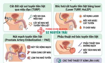 Phẫu thuật phì đại tuyến tiền liệt: Phương pháp, chi phí