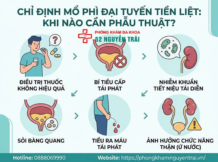 Phẫu thuật phì đại tuyến tiền liệt: Phương pháp, chi phí 6 Chỉ định mổ phì đại tuyến tiền liệt
