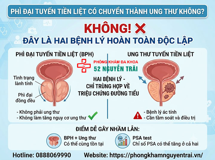 Phì đại tuyến tiền liệt có nguy hiểm không? Biến chứng cần biết 3 Phì đại tuyến tiền liệt có chuyển thành ung thư không?