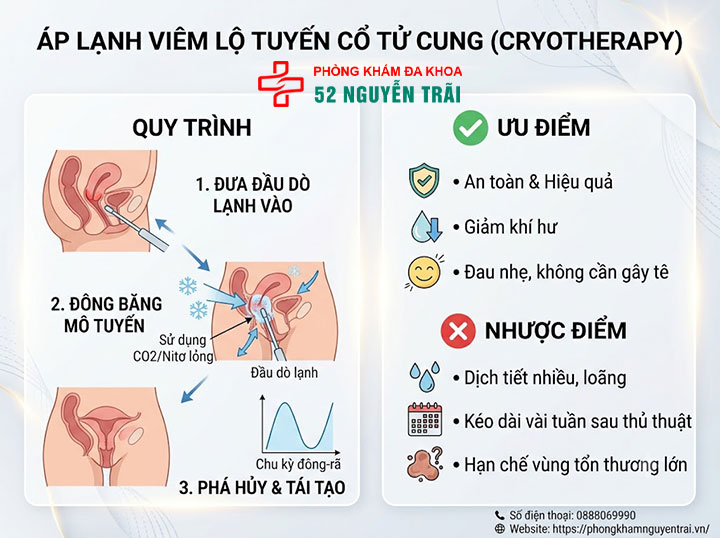 Đốt Viêm Lộ Tuyến Cổ Tử Cung: Phương Pháp, Chi Phí 4 Áp lạnh viêm lộ tuyến cổ tử cung