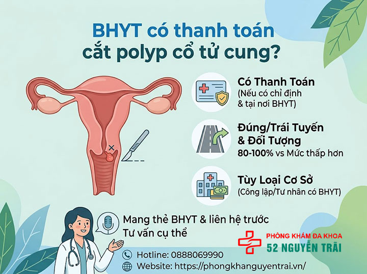 Chi Phí Cắt Polyp Cổ Tử Cung Hết Bao Nhiêu? 4 Bảo hiểm y tế có thanh toán cắt polyp cổ tử cung không?