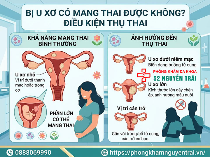 U Xơ Tử Cung Khi Mang Thai Có Nguy Hiểm Không? 3 Bị u xơ có mang thai được không? Điều kiện thụ thai
