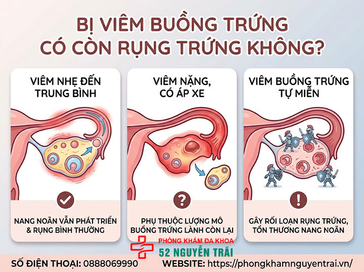 Viêm Buồng Trứng Có Nguy Hiểm Không? Giải Đáp Chi Tiết 4 Bị viêm buồng trứng có còn rụng trứng không?
