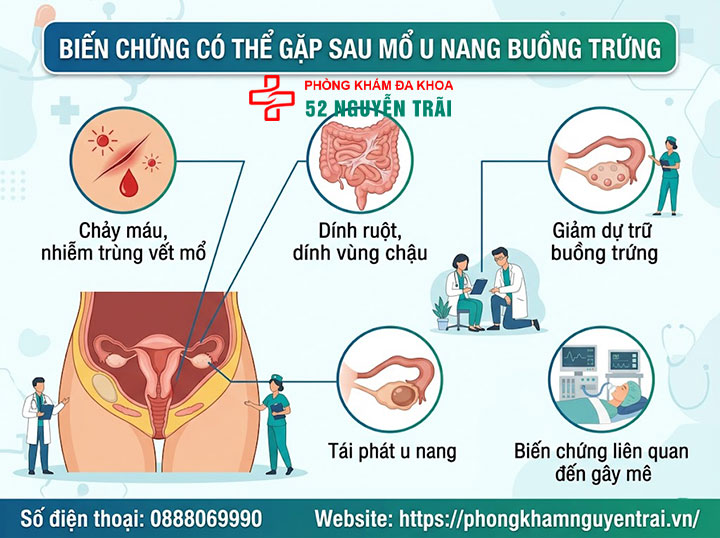 Mổ u nang buồng trứng: Khi nào cần, quy trình, chi phí 10 Biến chứng có thể gặp sau mổ u nang buồng trứng