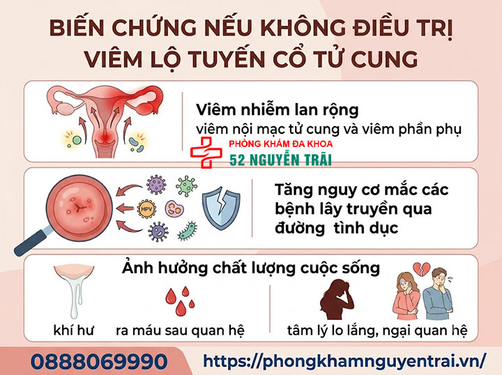 Viêm Lộ Tuyến Cổ Tử Cung Có Nguy Hiểm Không? 4 Biến chứng nếu không điều trị Viêm lộ tuyến cổ tử cung