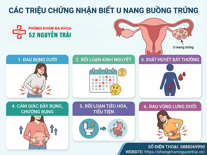 Dấu hiệu u nang buồng trứng và có nguy hiểm không? 2 Các triệu chứng nhận biết u nang buồng trứng
