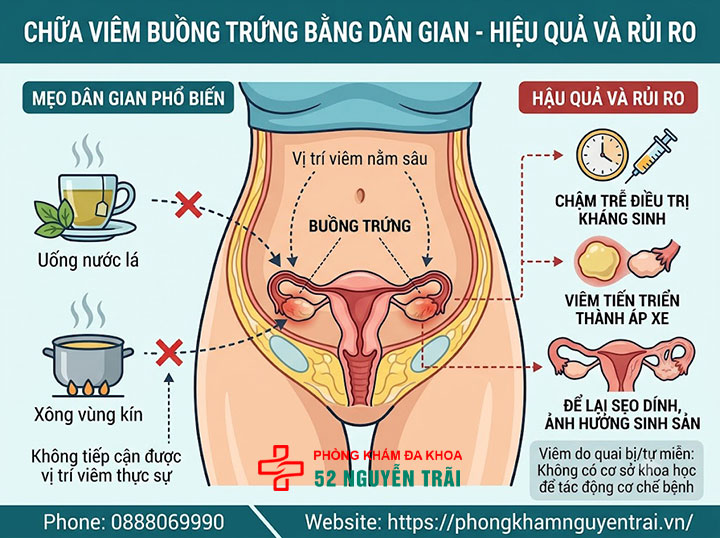Điều Trị Viêm Buồng Trứng: Kháng Sinh Và Phác Đồ 5 Chữa viêm buồng trứng bằng dân gian – hiệu quả và rủi ro