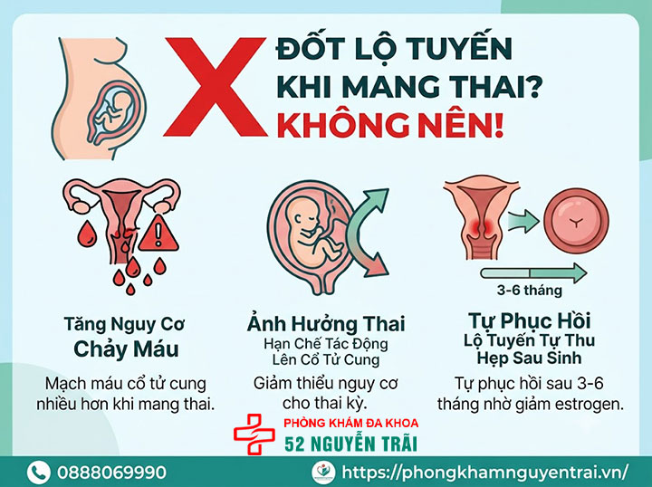 Viêm Lộ Tuyến Cổ Tử Cung Khi Mang Thai Có Sao Không? 3 Có nên đốt lộ tuyến khi đang mang thai không?