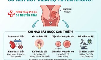 Đốt Viêm Lộ Tuyến Cổ Tử Cung: Phương Pháp, Chi Phí