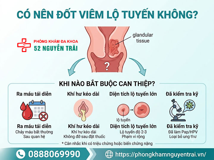 Đốt Viêm Lộ Tuyến Cổ Tử Cung: Phương Pháp, Chi Phí 1 Có nên đốt viêm lộ tuyến không? Khi nào bắt buộc can thiệp?