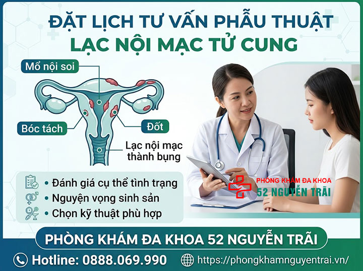Mổ Lạc Nội Mạc Tử Cung: Khi Nào Cần, Chi Phí 9 Đặt lịch tư vấn phẫu thuật lạc nội mạc tử cung