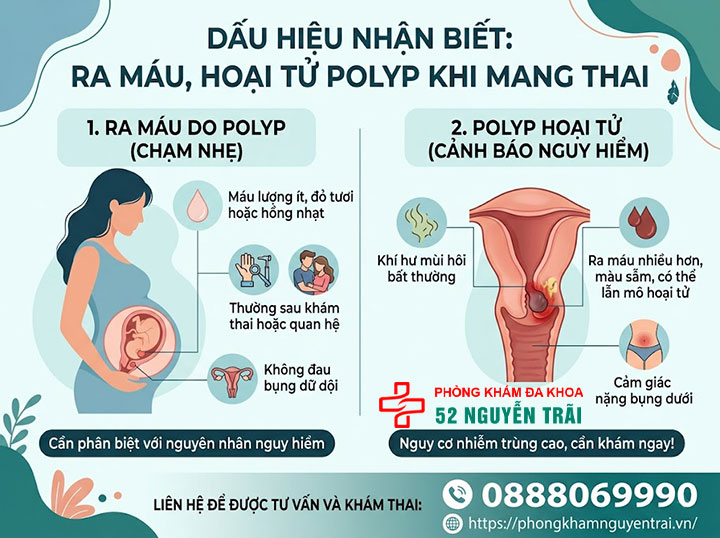 Polyp Cổ Tử Cung Khi Mang Thai Có Nguy Hiểm Không? 3 Dấu hiệu nhận biết: ra máu, hoại tử polyp khi mang thai