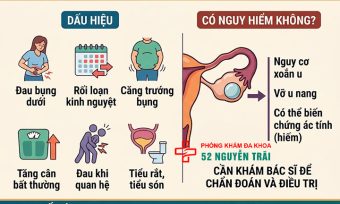 Dấu hiệu u nang buồng trứng và có nguy hiểm không?