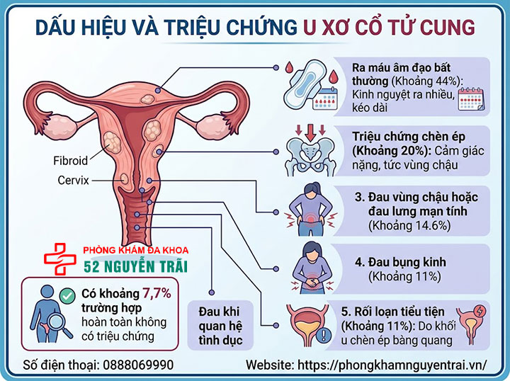 U Xơ Cổ Tử Cung Là Gì? Dấu Hiệu Và Cách Điều Trị 2 Dấu hiệu và triệu chứng u xơ cổ tử cung