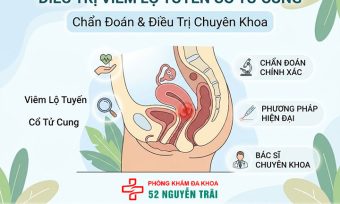 Điều Trị Viêm Lộ Tuyến Cổ Tử Cung