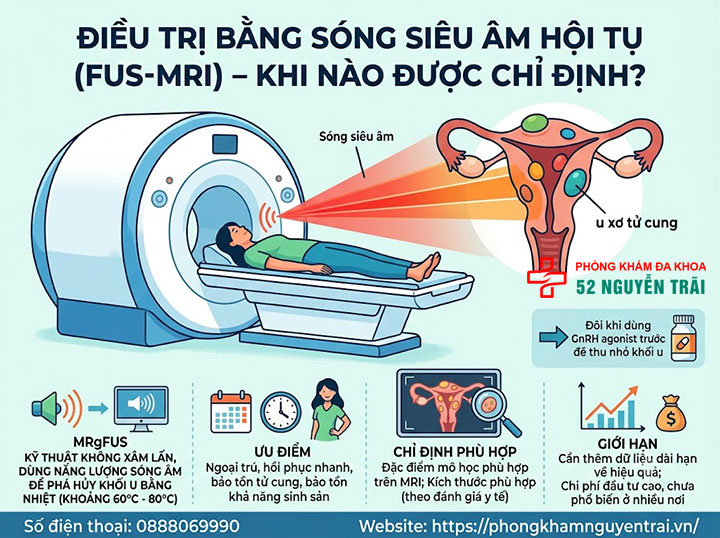 Điều Trị U Xơ Tử Cung Không Cần Phẫu Thuật 4 Điều trị bằng sóng siêu âm hội tụ (FUS-MRI) – khi nào được chỉ định?