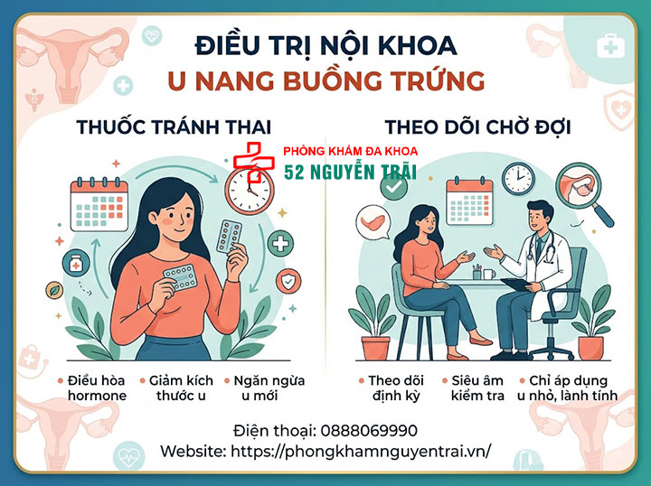Điều trị u nang buồng trứng: Thuốc, đông y, dinh dưỡng 2 Điều trị nội khoa u nang buồng trứng: Thuốc tránh thai, theo dõi chờ đợi