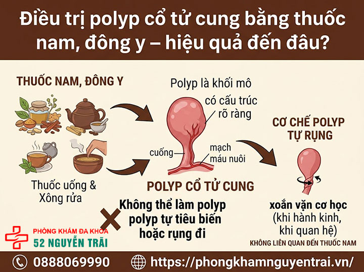 Cắt, Xoắn, Đốt Polyp Cổ Tử Cung: Phương Pháp, Quy Trình 4 Điều trị polyp cổ tử cung bằng thuốc nam, đông y – hiệu quả đến đâu?