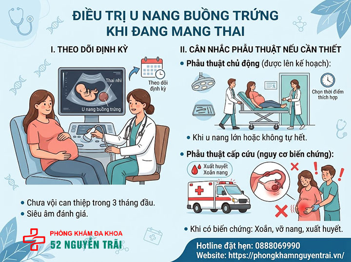 U nang buồng trứng có thai được không? Giải đáp chi tiết 3 Điều trị u nang buồng trứng khi đang mang thai